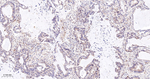 TIMP1 Antibody in Immunohistochemistry (Paraffin) (IHC (P))