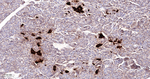 TIMP1 Antibody in Immunohistochemistry (Paraffin) (IHC (P))