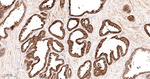 TIMP1 Antibody in Immunohistochemistry (Paraffin) (IHC (P))