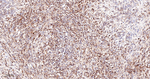TIMP1 Recombinant Rabbit Monoclonal Antibody (3G17)