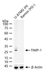 TIMP1 Antibody in Western Blot (WB)