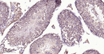 TRAF2 Antibody in Immunohistochemistry (Paraffin) (IHC (P))