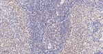 TRIM28 Antibody in Immunohistochemistry (Paraffin) (IHC (P))