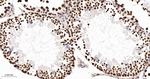 TRIM28 Antibody in Immunohistochemistry (Paraffin) (IHC (P))