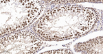 TRIM28 Antibody in Immunohistochemistry (Paraffin) (IHC (P))