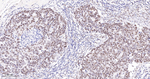 TRIM28 Antibody in Immunohistochemistry (Paraffin) (IHC (P))
