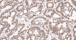 TRIM28 Antibody in Immunohistochemistry (Paraffin) (IHC (P))