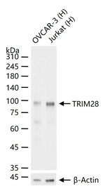 TRIM28 Antibody in Western Blot (WB)