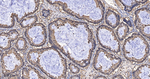 Thioredoxin 1 Antibody in Immunohistochemistry (Paraffin) (IHC (P))
