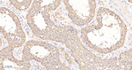 UBE1 Antibody in Immunohistochemistry (Paraffin) (IHC (P))