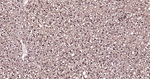 Ub-K48 Antibody in Immunohistochemistry (Paraffin) (IHC (P))