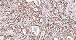 Ub-K48 Recombinant Rabbit Monoclonal Antibody (20B9)