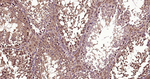 Ub-K48 Antibody in Immunohistochemistry (Paraffin) (IHC (P))