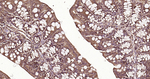 Ub-K63 Antibody in Immunohistochemistry (Paraffin) (IHC (P))