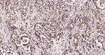 Ub-K63 Recombinant Rabbit Monoclonal Antibody (6H18)