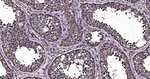 Ub-K63 Antibody in Immunohistochemistry (Paraffin) (IHC (P))