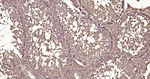 Ub-K63 Antibody in Immunohistochemistry (Paraffin) (IHC (P))