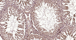 Ub-K63 Antibody in Immunohistochemistry (Paraffin) (IHC (P))