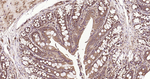 Ub-K63 Antibody in Immunohistochemistry (Paraffin) (IHC (P))