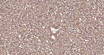 Ub-K63 Antibody in Immunohistochemistry (Paraffin) (IHC (P))