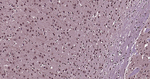 Ubiquitin (linkage specific K27) Antibody in Immunohistochemistry (Paraffin) (IHC (P))