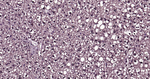Ubiquitin (linkage specific K27) Antibody in Immunohistochemistry (Paraffin) (IHC (P))