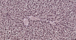 Ubiquitin (linkage specific K27) Antibody in Immunohistochemistry (Paraffin) (IHC (P))