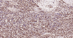 Ubiquitin (linkage specific K27) Antibody in Immunohistochemistry (Paraffin) (IHC (P))