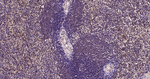 Ubiquitin (linkage specific K27) Antibody in Immunohistochemistry (Paraffin) (IHC (P))