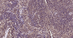 Ubiquitin (linkage specific K27) Antibody in Immunohistochemistry (Paraffin) (IHC (P))