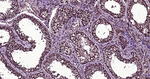 Ubiquitin (linkage specific K27) Antibody in Immunohistochemistry (Paraffin) (IHC (P))