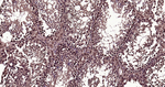 Ubiquitin (linkage specific K27) Antibody in Immunohistochemistry (Paraffin) (IHC (P))