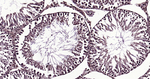 Ubiquitin (linkage specific K27) Antibody in Immunohistochemistry (Paraffin) (IHC (P))