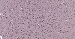 Ubiquitin (linkage specific K27) Antibody in Immunohistochemistry (Paraffin) (IHC (P))