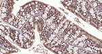 Ubiquitin (linkage specific K27) Antibody in Immunohistochemistry (Paraffin) (IHC (P))