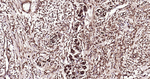 Ubiquitin (linkage specific K27) Antibody in Immunohistochemistry (Paraffin) (IHC (P))