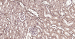 Ubiquitin (linkage specific K27) Antibody in Immunohistochemistry (Paraffin) (IHC (P))