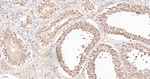 Ubiquitin Antibody in Immunohistochemistry (Paraffin) (IHC (P))