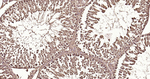 Ubiquitin Antibody in Immunohistochemistry (Paraffin) (IHC (P))