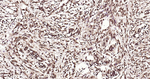 Ubiquitin Antibody in Immunohistochemistry (Paraffin) (IHC (P))