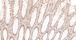 Ubiquitin Antibody in Immunohistochemistry (Paraffin) (IHC (P))