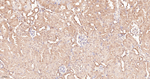 Ubiquitin Antibody in Immunohistochemistry (Paraffin) (IHC (P))
