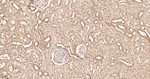 Ubiquitin Antibody in Immunohistochemistry (Paraffin) (IHC (P))