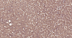 Ubiquitin Antibody in Immunohistochemistry (Paraffin) (IHC (P))