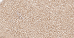 Ubiquitin Antibody in Immunohistochemistry (Paraffin) (IHC (P))