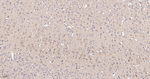 UCHL3 Antibody in Immunohistochemistry (Paraffin) (IHC (P))