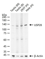 USP28 Recombinant Rabbit Monoclonal Antibody (4B2)