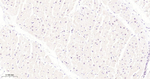 USP28 Antibody in Immunohistochemistry (Paraffin) (IHC (P))