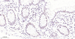 USP28 Recombinant Rabbit Monoclonal Antibody (1C9)
