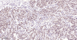 USP28 Antibody in Immunohistochemistry (Paraffin) (IHC (P))